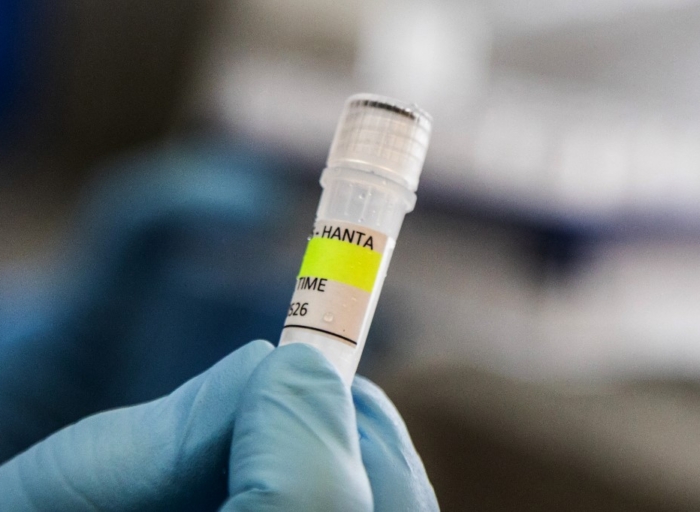 UK identifies new suspected hantavirus case on remote island